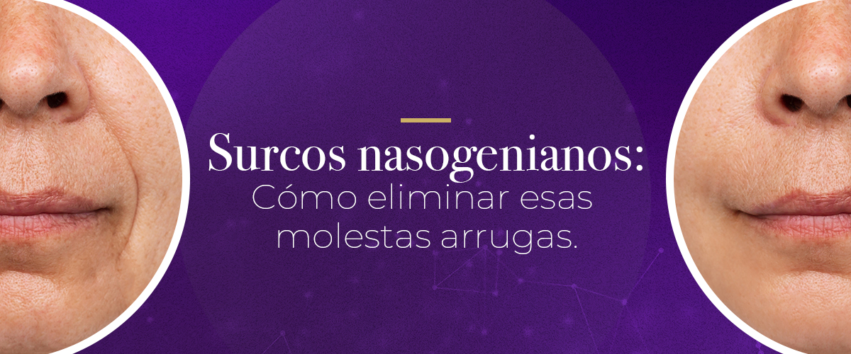 Surcos nasogenianos: Cómo eliminar esas molestas arrugas