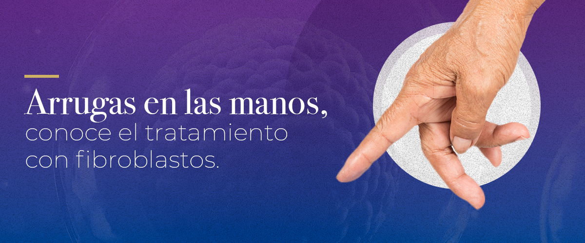 Arrugas en las manos, conoce el tratamiento con fibroblastos autólogos