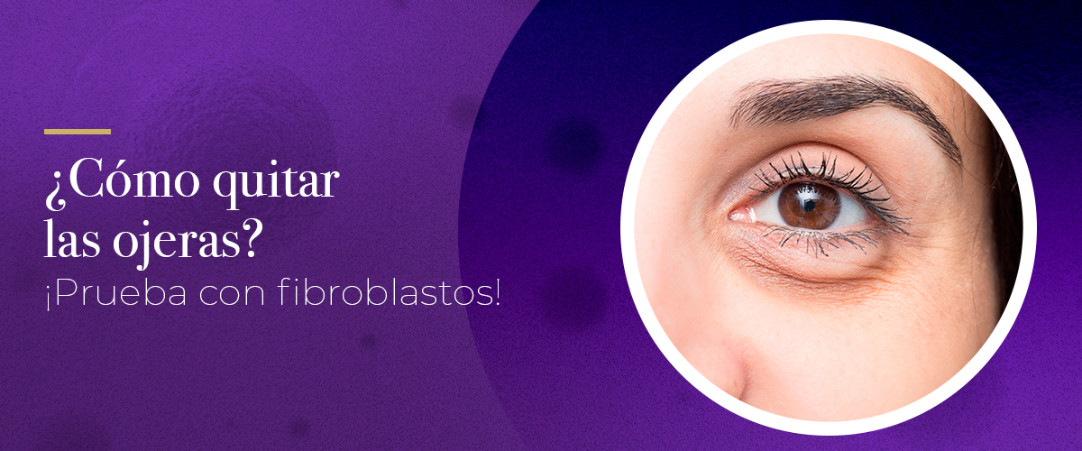 ¿Cómo quitar las ojeras? ¡Prueba con fibroblastos!